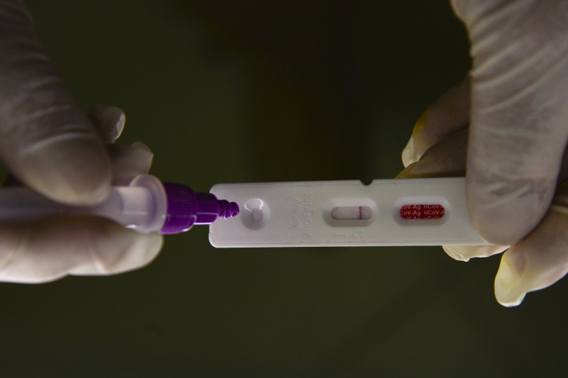 Brasil registra 18,5 mil novos casos e 53 mortes por covid-19