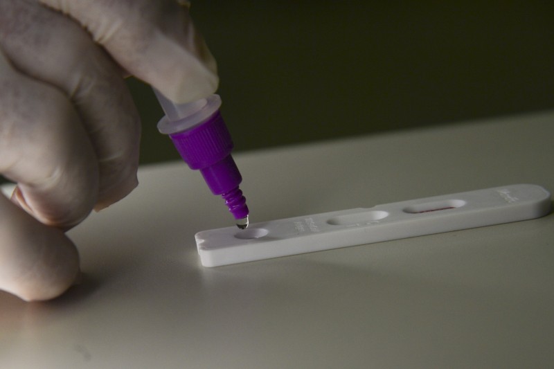 Covid-19: Brasil registra 266 óbitos e 77,1 mil casos em 24 horas