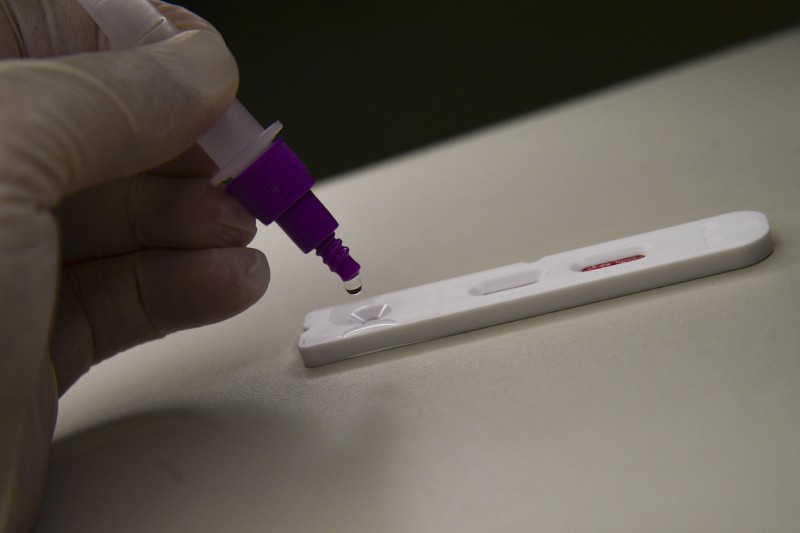 Fiocruz: casos de síndrome respiratória grave atingem patamar estável